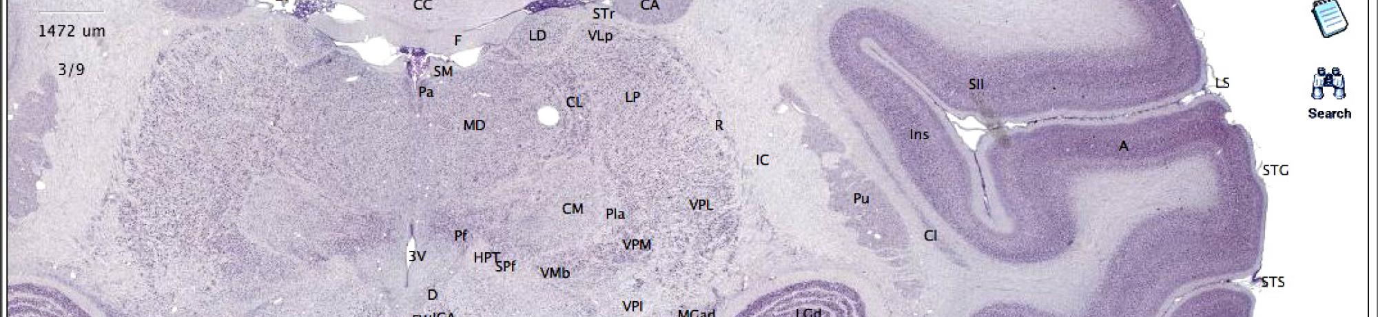 Brain Maps Image
